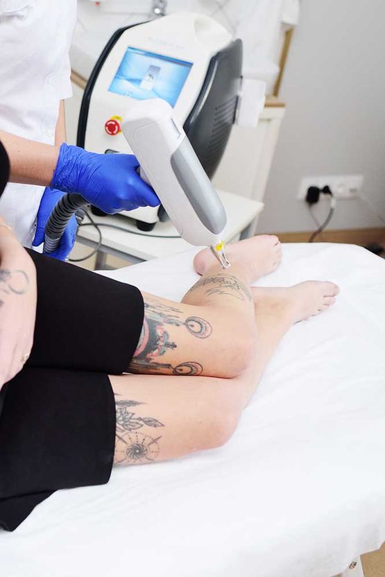 Kosmetikerin entfernt das Tattoo am Bein eines jungen hübschen Mädchens mit einem Laser